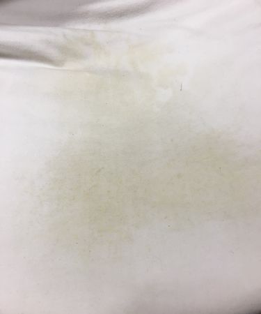 被子发霉晒不掉又不能洗怎么办
