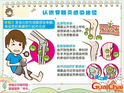 ​骨髓炎的症状表现？骨髓炎是什么病严重吗