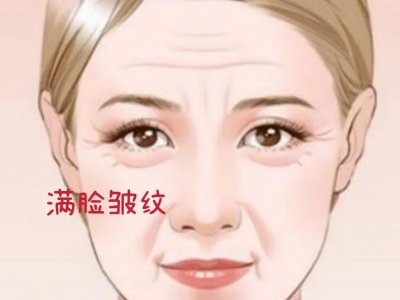​去除脸部皱纹最好最快方法（去除皱纹，又快又有效的妙招，你知道用啥东西吗？