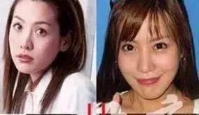 韩国整容女明星捏鼻子（又一女星整成猪鼻子）(31)