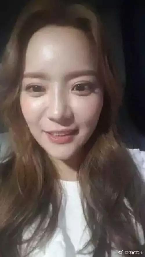 韩国整容女明星捏鼻子（又一女星整成猪鼻子）(45)