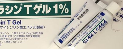 ​后背上长痘痘是何原因造成的