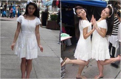 ​大象腿怎么形成的 大象腿会遗传吗