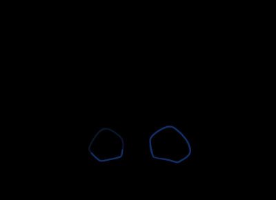 ​让婚姻幸福起来的距离是多少？