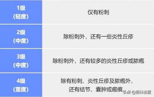 背上长痘痘怎么治疗用什么药(脸上背上长痘痘怎么治疗)-第1张图片-