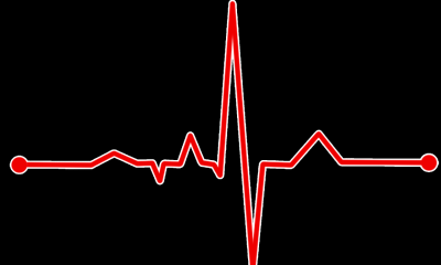 ​正常静息心率似乎因人而异