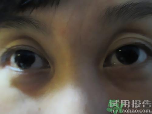 蛇毒眼膜效果怎么样?spa蛇毒眼膜红色好用吗? 蛇毒眼膜效果怎么样?spa蛇毒眼膜红色好用吗?