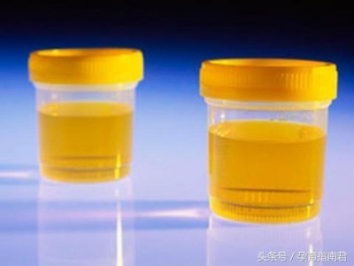 ​tp医学缩写什么意思（教你看孕检单上的+号）