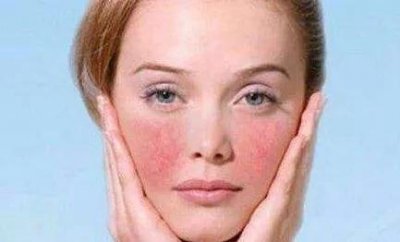 ​敏感肌平时怎么护理(敏感肌日常护肤步骤)