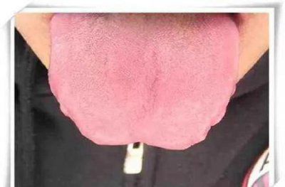 ​男性脾虚的症状及调理方法