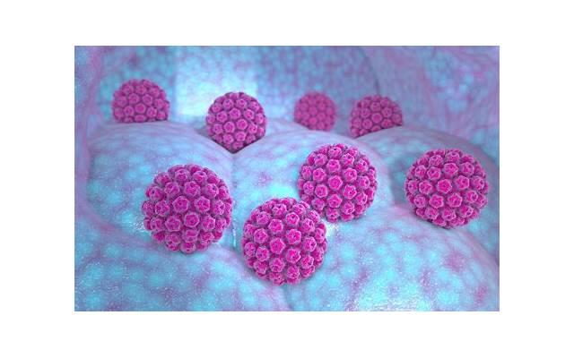 老婆感染hpv是出轨了么，老婆感染HPV了，是出轨了吗？