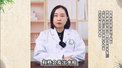 ​蛇缠腰长满一圈，就会死人吗