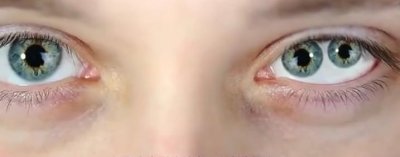 ​世界上双瞳孔的人看东西会有什么不一样？