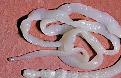 ​什么是绦虫？