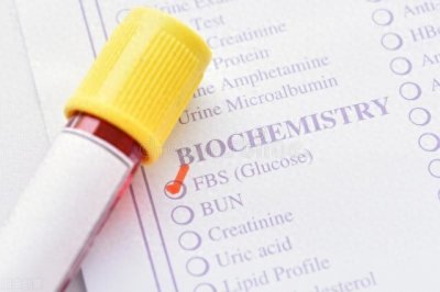 什么是空腹？空腹应该注意些什么？