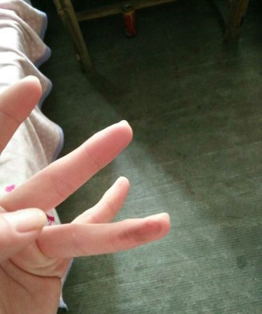 有什么办法能去掉粘在手上的胶水