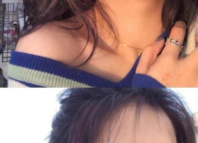 ​肛门的结构是什么样的？