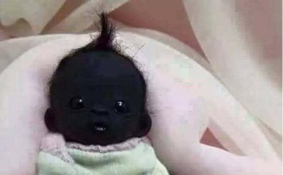 ​盘点全球长相最奇特的四个婴儿（世界上最黝黑的婴儿）