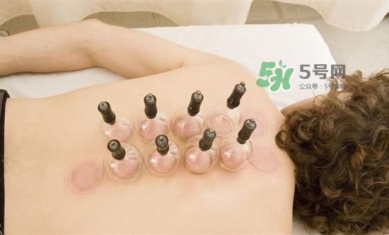 下雨天可以拔罐吗?下雨天拔罐有影响吗? 下雨天可以拔罐吗?下雨天拔罐有影响吗?