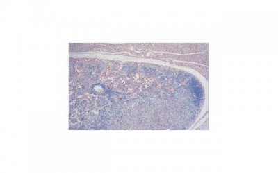 ​学生时代的爱情能走到最后吗？现实很残酷