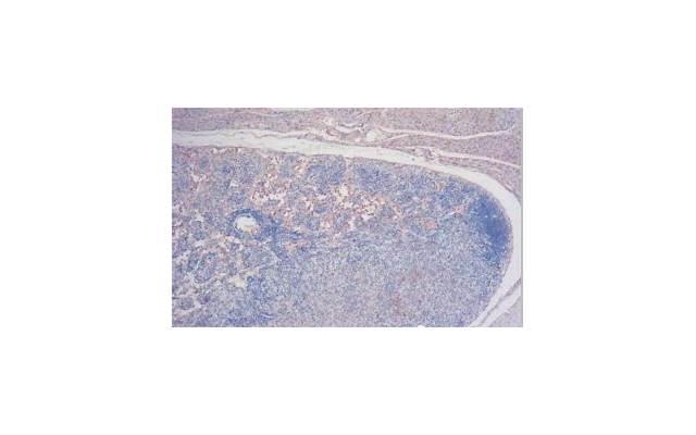 学生时代的爱情能走到最后吗？现实很残酷