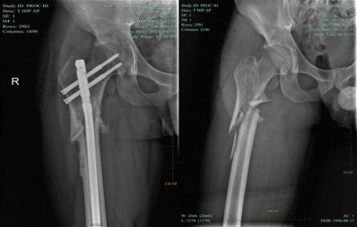 ​医者仁心感动疆鄂！新疆小伙的三千公里“折返跑”